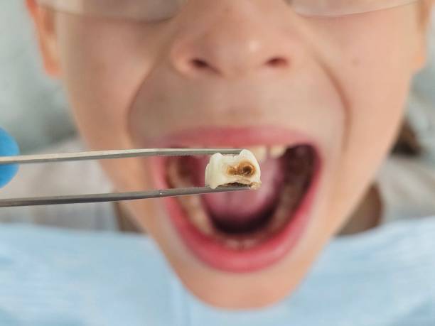Best Walk-In Emergency Dental Services in Horse Cave, KY